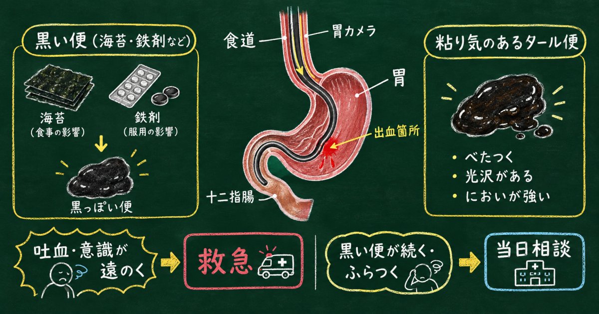 黒い便で消化器内科を受診するタイミングと胃カメラでわかる原因